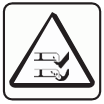 Amputation hazard under deck
